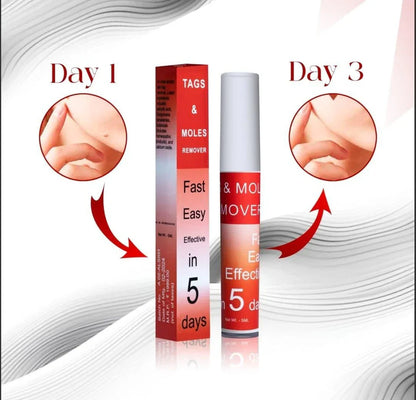 Ayurcare™ tags & mole remover