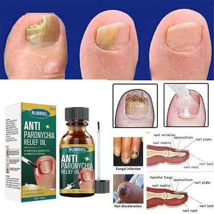 Anti Paronychia Nail Relief Oil - Natural Nail Infection Treatment