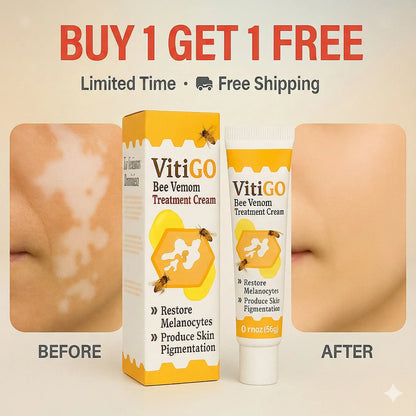 Bee Venom Vitiligo Correcting Cream - Pack of 2